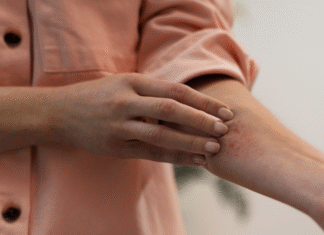 Saiba como evitar as 6 doenças de pele mais frequentes no verão