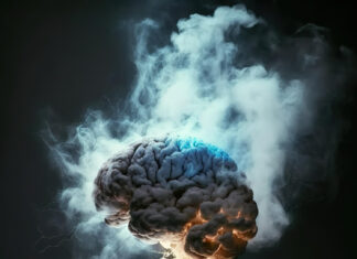 Agosto Azul Vermelho alerta para a importância de exames vasculares AVC - aneurismas - exames vasculares