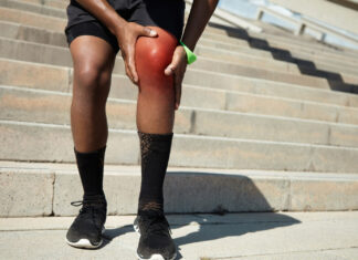 Internações por trombose venosa no Brasil chegam a casa de 165 por dia Trombose venosa