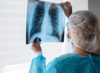 Exames de imagem ajudam no diagnóstico precoce de doenças respiratórias Exame de imagem