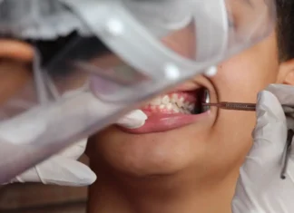 Brasil tem 45% de cobertura em saúde bucal; meta é chegar a 70% saúde bucal Brasil