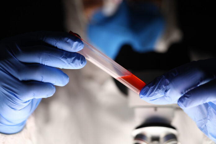 biópsia líquida biópsia líquida