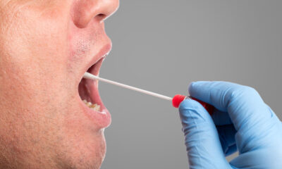 saliva doce