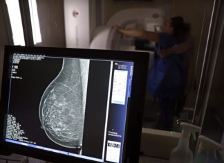 Entidades médicas pedem faixa etária maior para mamografia de rastreio mamografia de rastreio câncer de mama