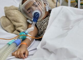 Bronquiolite: maior causa de internação por infecção respiratória em crianças Bronquiolite