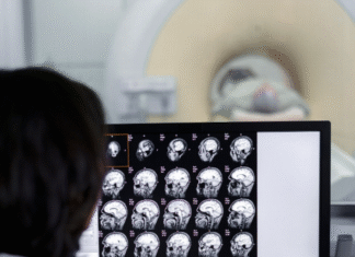 SUS concentra maior parte dos exames de imagem no país