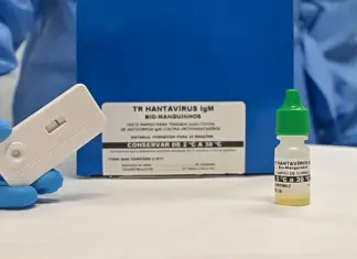 Anvisa aprova teste rápido de 20 minutos para hantavirose