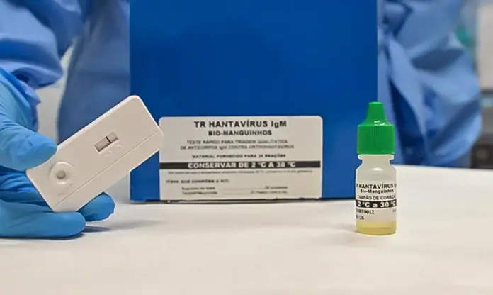 Teste para hantavírus-© Rudson Amorim