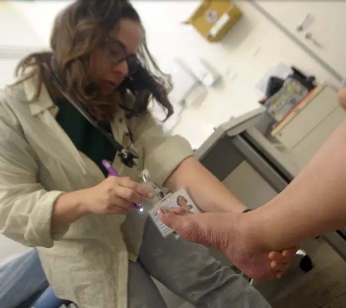 Análise de pé-Divulgação-Agência Saúde DF Micose no verão: secar bem os pés após o banho ajuda a prevenir frieira e outras micoses no Distrito Federal