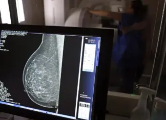Lei reforça folga para exame preventivo sem desconto mamografia